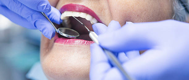 Best Dentist for Dental Trauma  in Lamont, CA